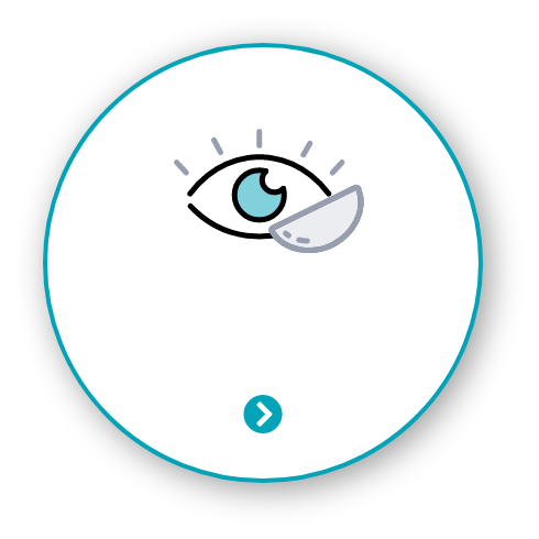 コンタクトレンズ